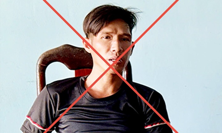 'Chồng hờ' bạo hành con gái riêng của vợ đến chấn thương não